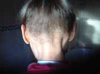 tn_Hair 10 Jan 2017.JPG